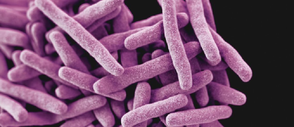 Tuberculosis Travel Advice