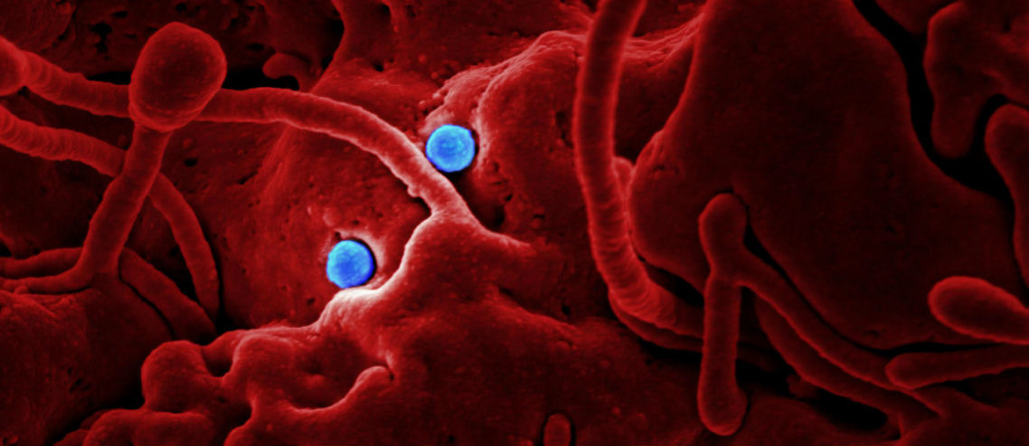 Everything you need to know about the new viral pneumonia
